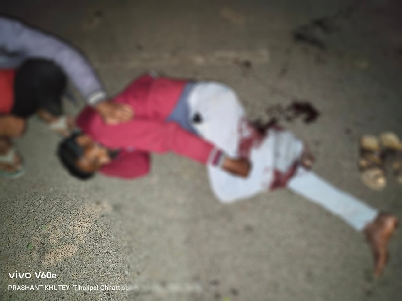 बिग ब्रेकिंग: सरसीवा मार्ग पर ट्रैक्टर का कहर - बाइक सवार का पैर तोड़, चालक फरार ! हादसे में 1 गंभीर घायल