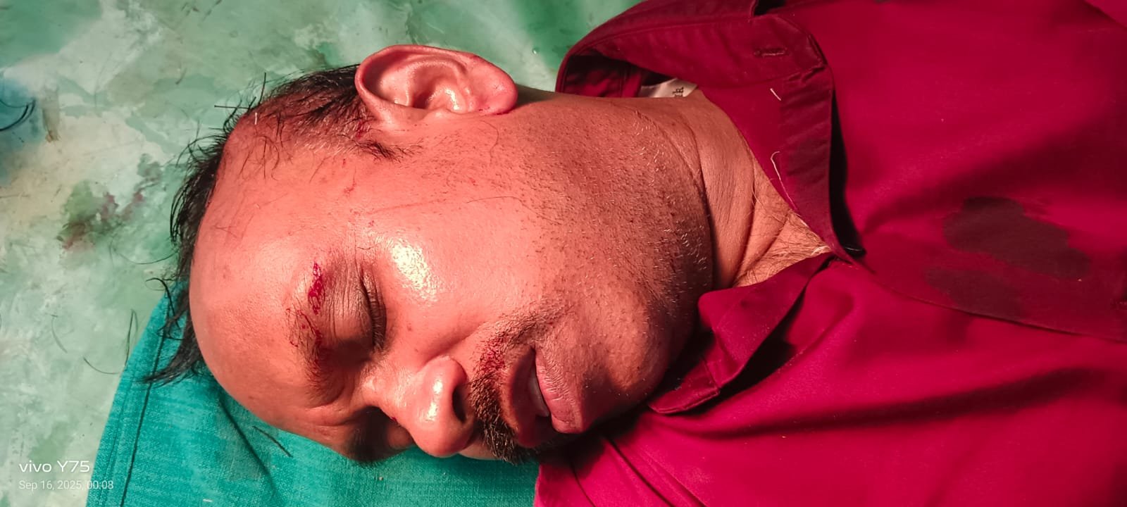 तेज रफ्तार कार ने पत्रकार शशिकांत देवांगन को मारी टक्कर, बाल-बाल बचे