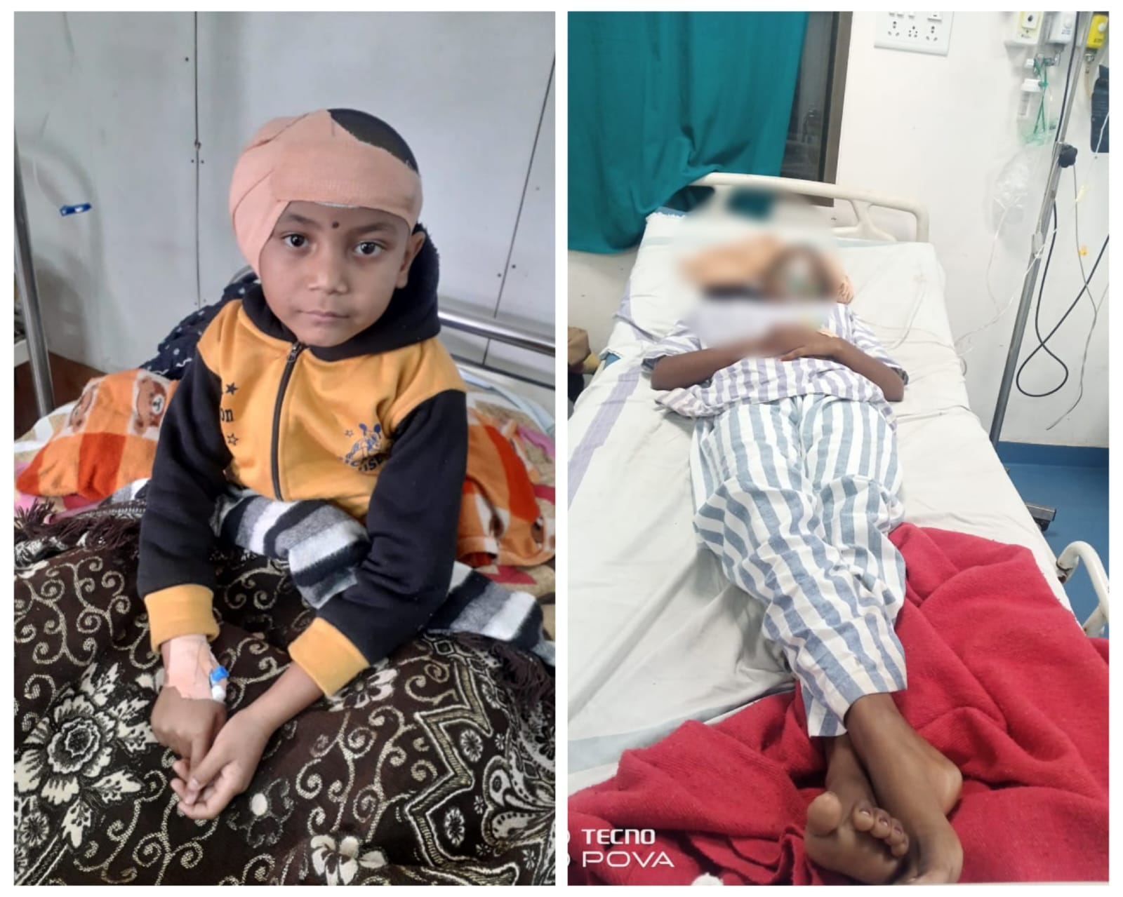 Baloda Bazar News : चिरायु योजना से संवर रही है जिंदगी,6 वर्षीय श्रेया अब सुन पाएगी आवाज